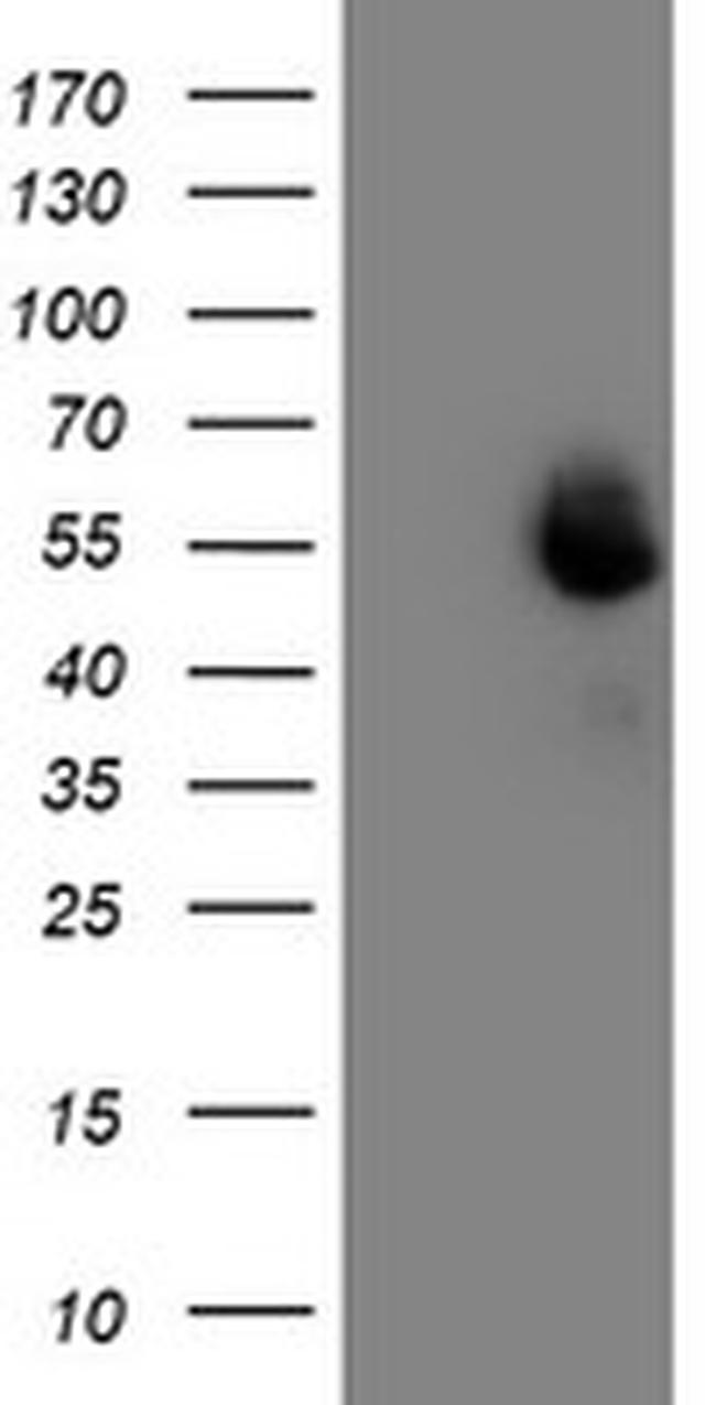 MEF2C Antibody in Western Blot (WB)