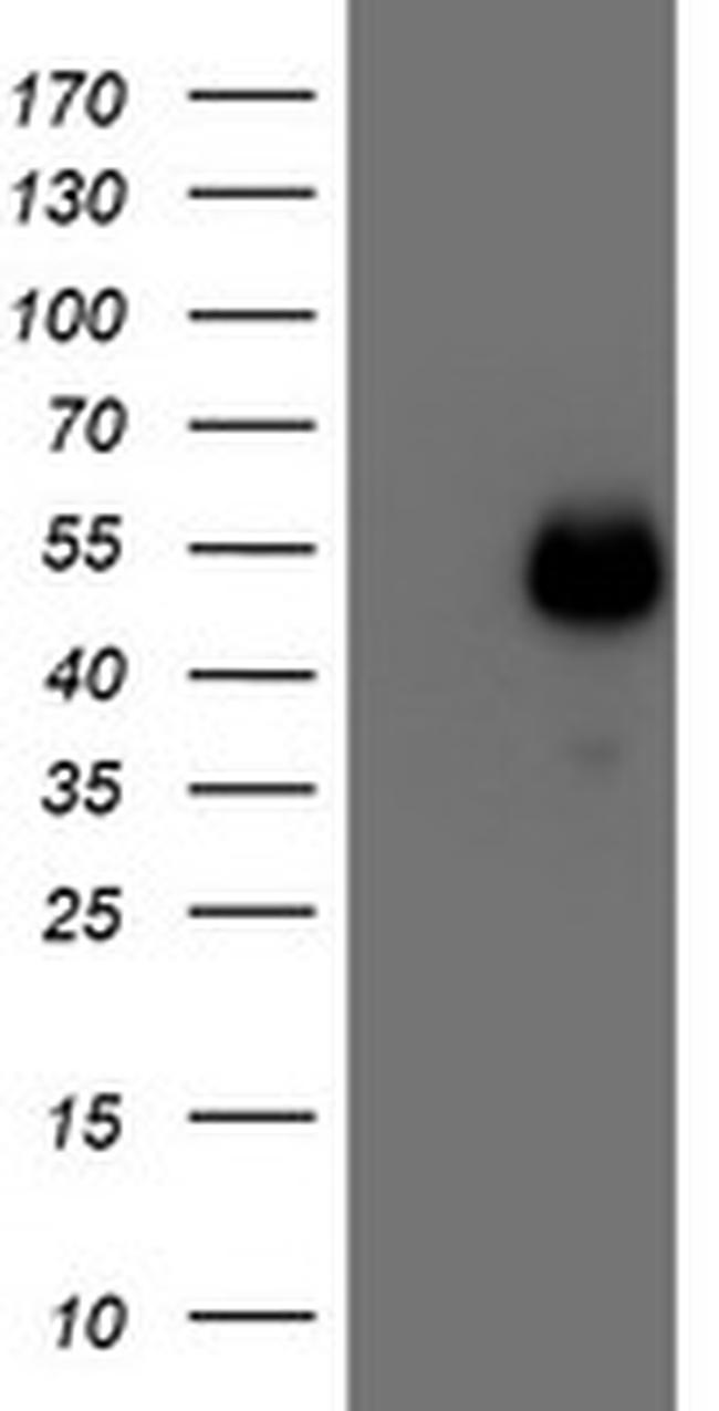 MEF2C Antibody in Western Blot (WB)