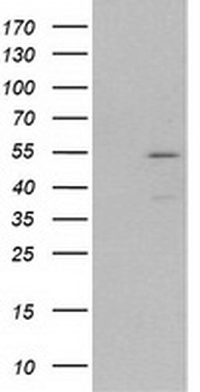 MEF2C Antibody in Western Blot (WB)