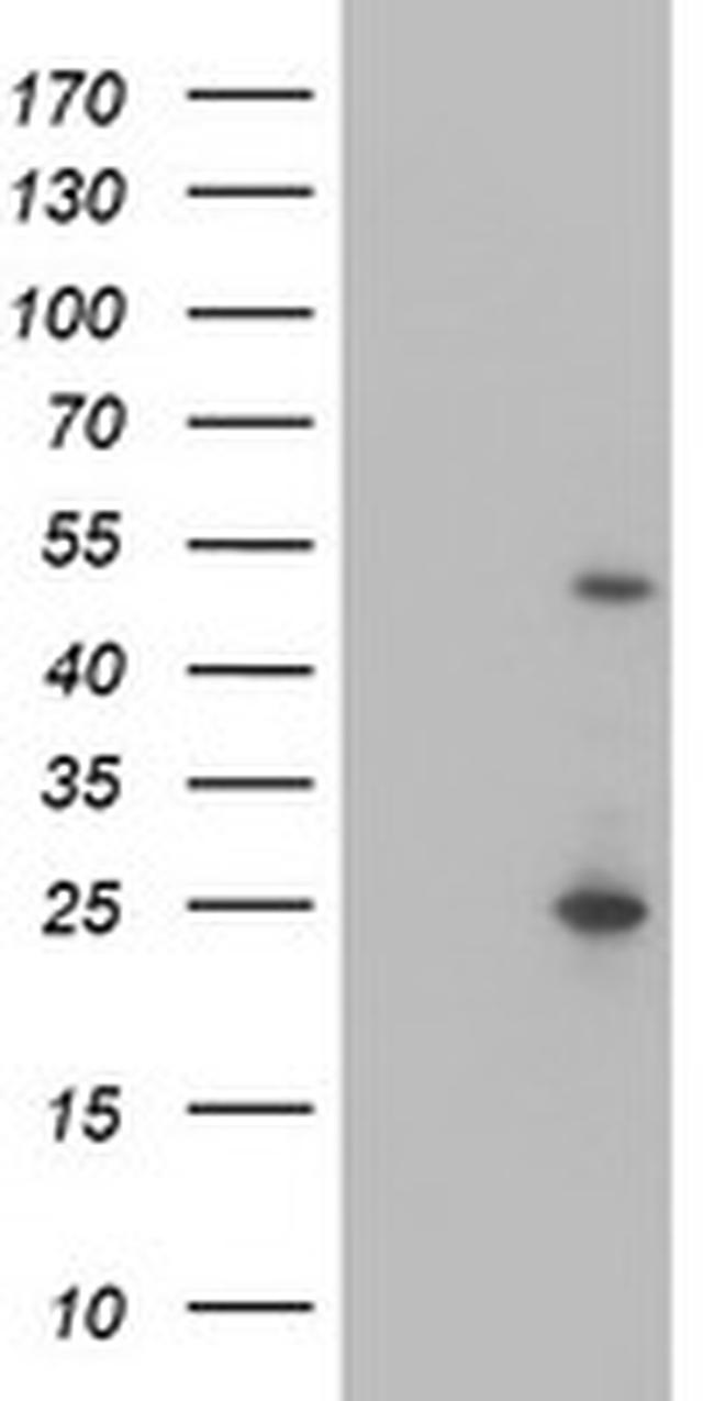 MEF2C Antibody in Western Blot (WB)