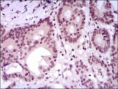 MEF2C Antibody in Immunohistochemistry (Paraffin) (IHC (P))