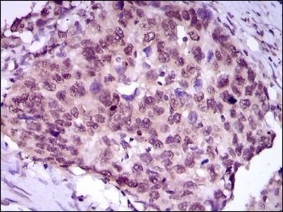 MEF2C Antibody in Immunohistochemistry (Paraffin) (IHC (P))