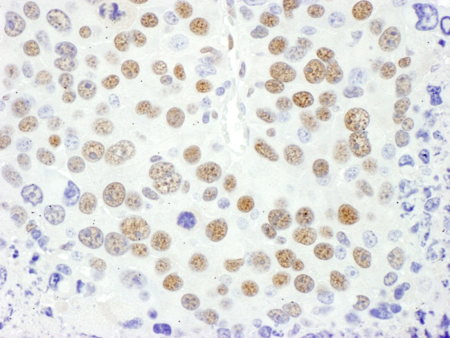 MEF2D Antibody in Immunohistochemistry (IHC)