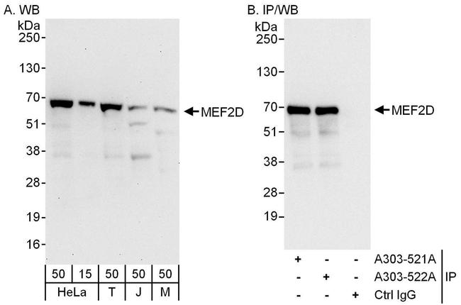 MEF2D Antibody in Western Blot (WB)