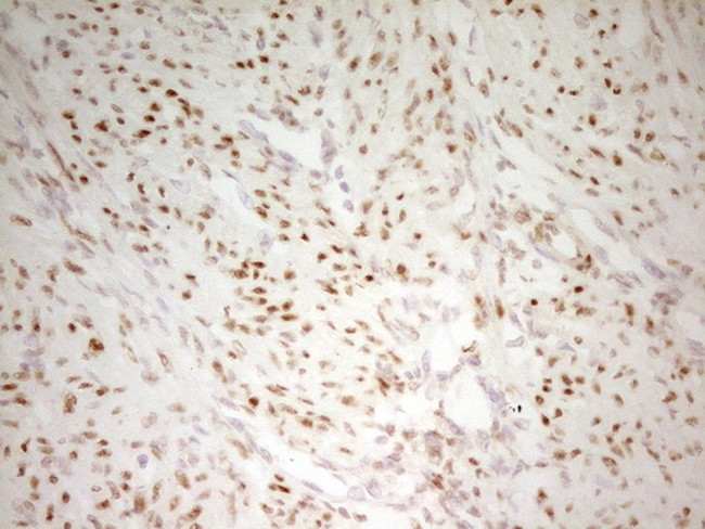 MEF2D Antibody in Immunohistochemistry (Paraffin) (IHC (P))