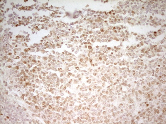 MEF2D Antibody in Immunohistochemistry (Paraffin) (IHC (P))