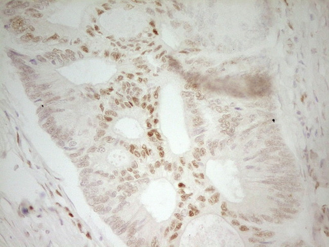 MEF2D Antibody in Immunohistochemistry (Paraffin) (IHC (P))