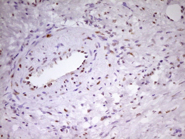 MEF2D Antibody in Immunohistochemistry (Paraffin) (IHC (P))