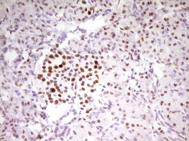 MEF2D Antibody in Immunohistochemistry (Paraffin) (IHC (P))