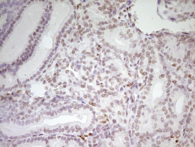 MEF2D Antibody in Immunohistochemistry (Paraffin) (IHC (P))