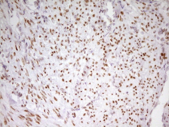 MEF2D Antibody in Immunohistochemistry (Paraffin) (IHC (P))