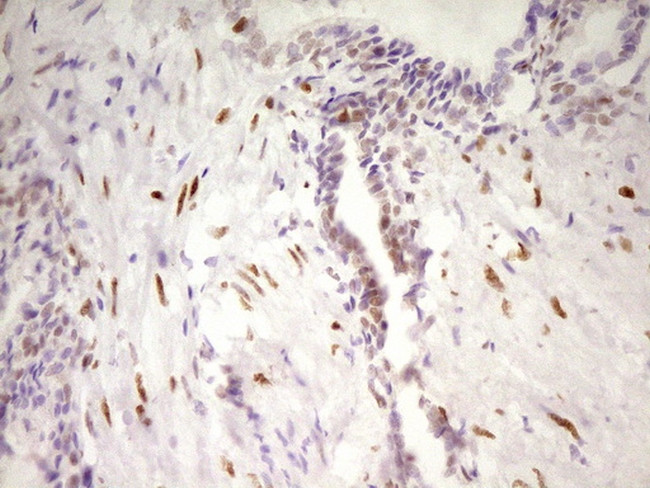 MEF2D Antibody in Immunohistochemistry (Paraffin) (IHC (P))