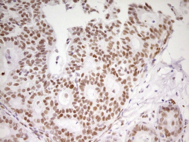 MEF2D Antibody in Immunohistochemistry (Paraffin) (IHC (P))