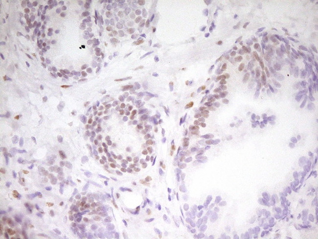 MEF2D Antibody in Immunohistochemistry (Paraffin) (IHC (P))