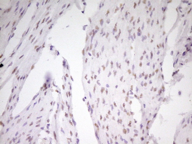 MEF2D Antibody in Immunohistochemistry (Paraffin) (IHC (P))