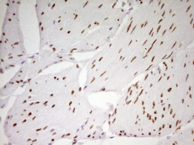 MEF2D Antibody in Immunohistochemistry (Paraffin) (IHC (P))