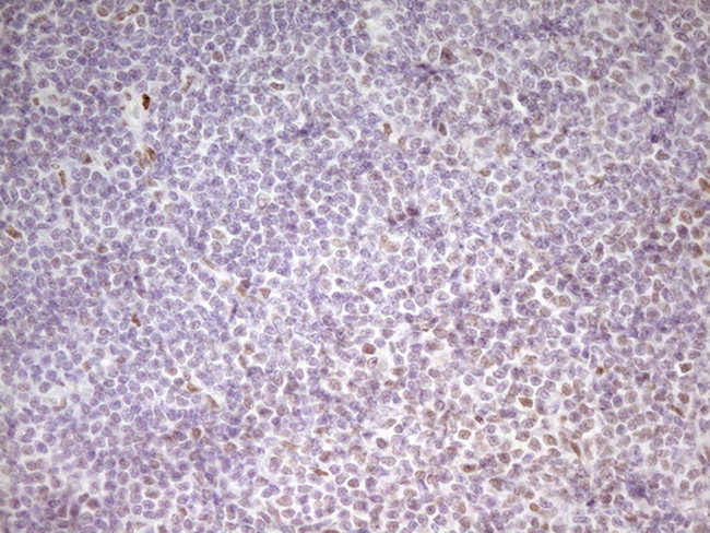 MEF2D Antibody in Immunohistochemistry (Paraffin) (IHC (P))