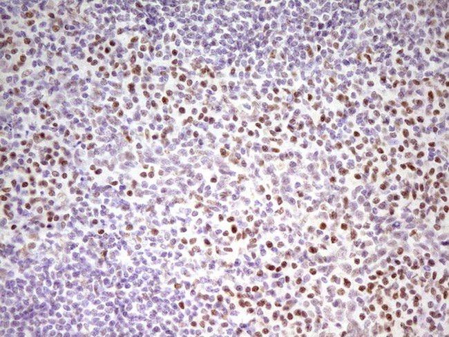 MEF2D Antibody in Immunohistochemistry (Paraffin) (IHC (P))