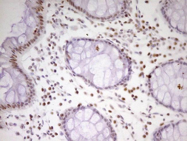 MEF2D Antibody in Immunohistochemistry (Paraffin) (IHC (P))