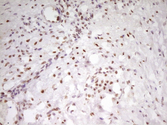 MEF2D Antibody in Immunohistochemistry (Paraffin) (IHC (P))