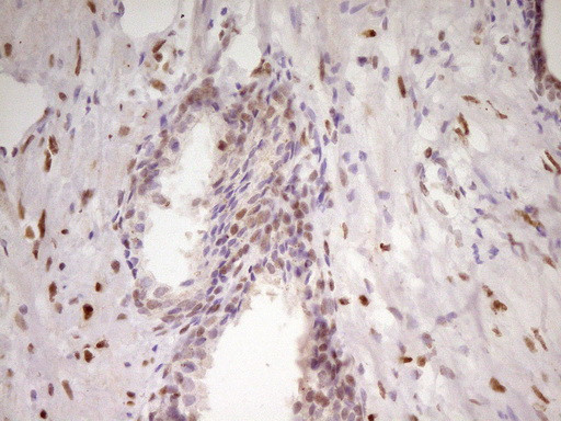 MEF2D Antibody in Immunohistochemistry (Paraffin) (IHC (P))