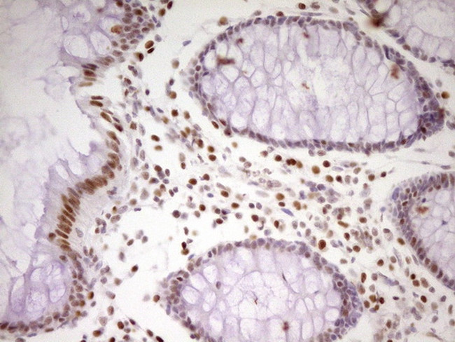 MEF2D Antibody in Immunohistochemistry (Paraffin) (IHC (P))