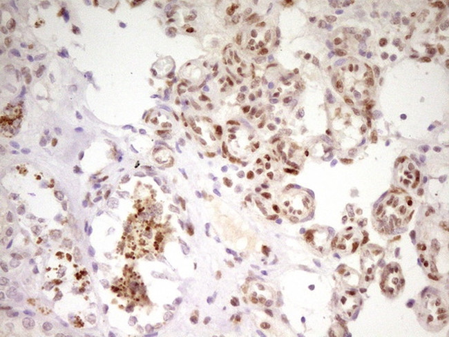 MEF2D Antibody in Immunohistochemistry (Paraffin) (IHC (P))