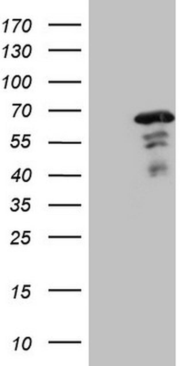 MEF2D Antibody in Western Blot (WB)