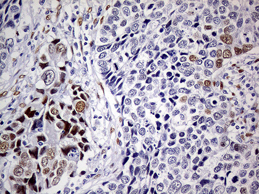 MEIS1 Antibody in Immunohistochemistry (Paraffin) (IHC (P))