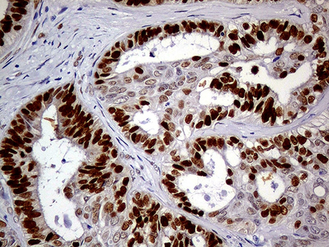 MEIS1 Antibody in Immunohistochemistry (Paraffin) (IHC (P))