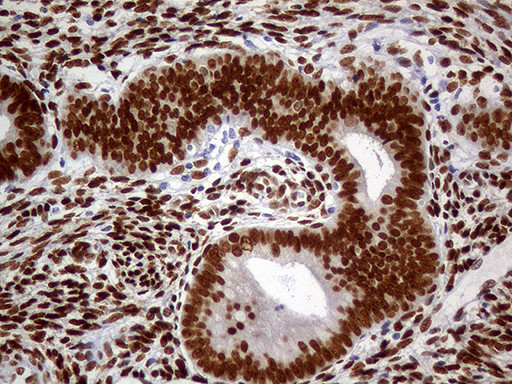 MEIS1 Antibody in Immunohistochemistry (Paraffin) (IHC (P))