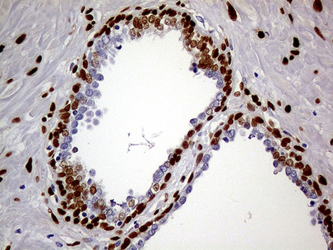 MEIS1 Antibody in Immunohistochemistry (Paraffin) (IHC (P))