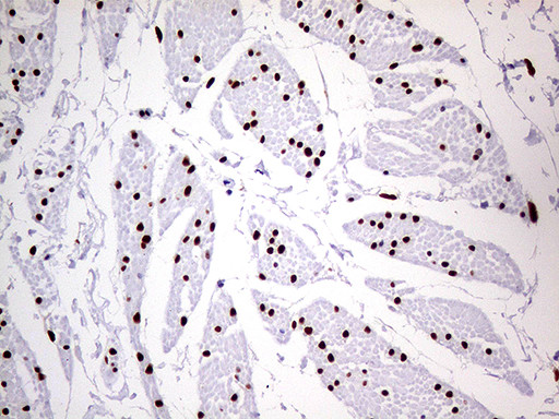 MEIS1 Antibody in Immunohistochemistry (Paraffin) (IHC (P))