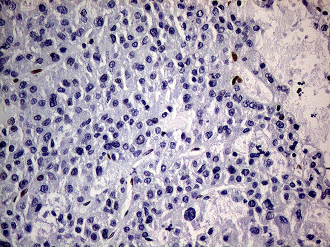 MEIS1 Antibody in Immunohistochemistry (Paraffin) (IHC (P))