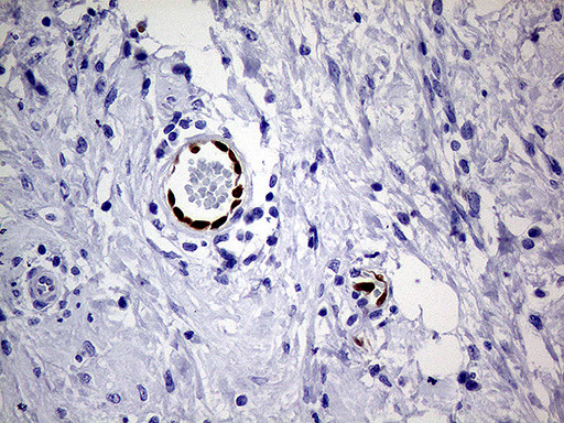 MEOX1 Antibody in Immunohistochemistry (Paraffin) (IHC (P))