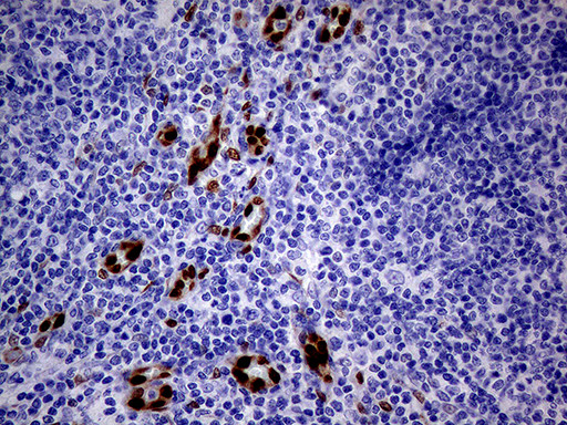 MEOX1 Antibody in Immunohistochemistry (Paraffin) (IHC (P))