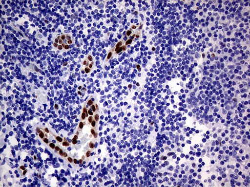 MEOX1 Antibody in Immunohistochemistry (Paraffin) (IHC (P))