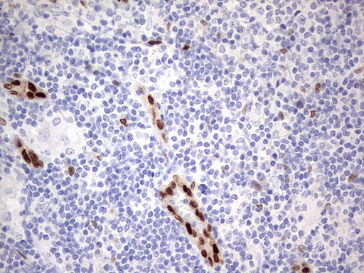 MEOX1 Antibody in Immunohistochemistry (Paraffin) (IHC (P))