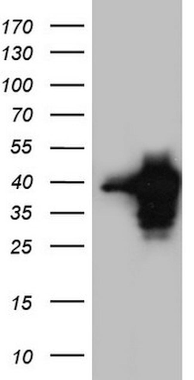 MEOX1 Antibody in Western Blot (WB)