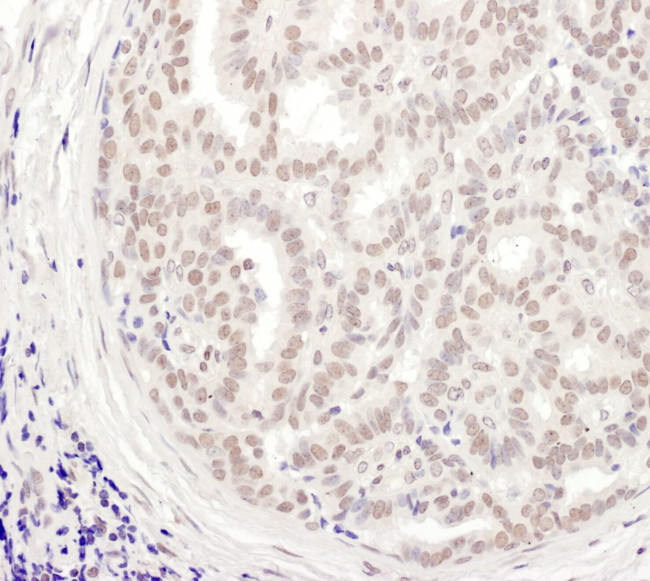 MEPCE Antibody in Immunohistochemistry (IHC)