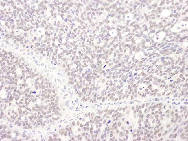 MEPCE Antibody in Immunohistochemistry (IHC)