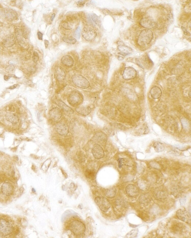 MERIT40 Antibody in Immunohistochemistry (IHC)