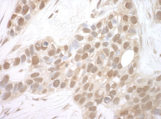 MERIT40 Antibody in Immunohistochemistry (IHC)