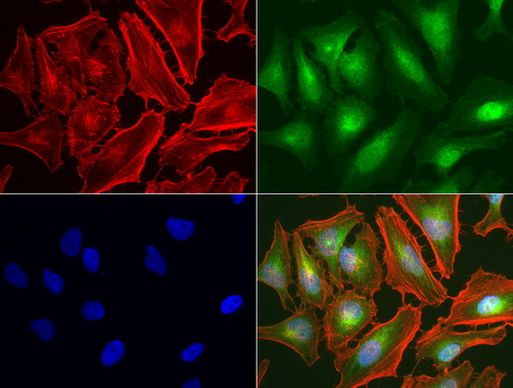 MET Antibody in Immunocytochemistry (ICC/IF)