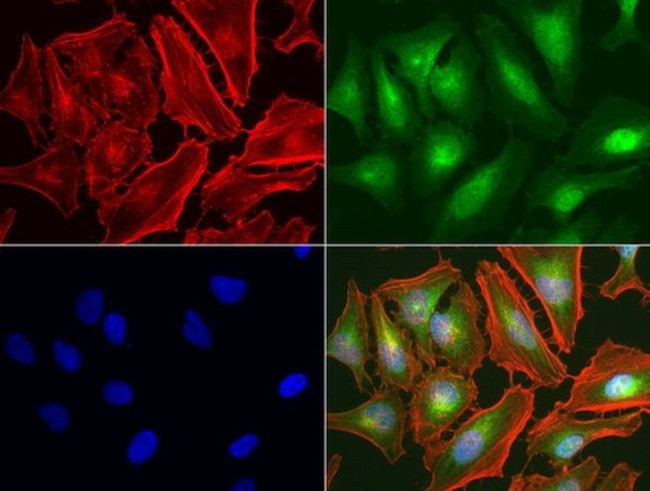 MET Antibody in Immunocytochemistry (ICC/IF)