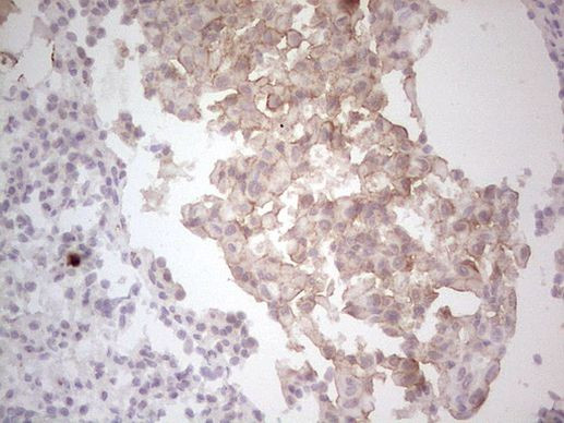 MET Antibody in Immunohistochemistry (Paraffin) (IHC (P))