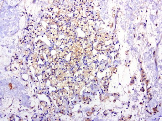 MET Antibody in Immunohistochemistry (Paraffin) (IHC (P))