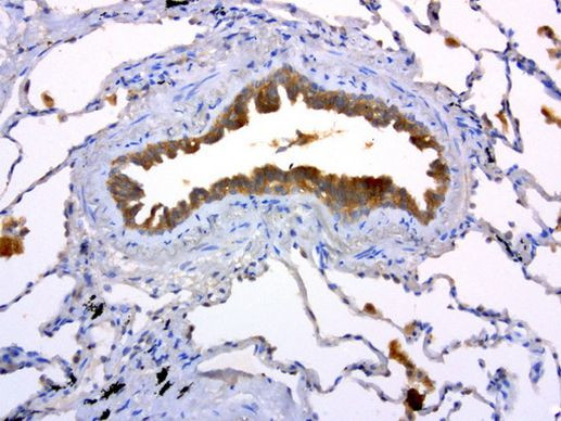 MET Antibody in Immunohistochemistry (Paraffin) (IHC (P))