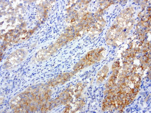 MET Antibody in Immunohistochemistry (Paraffin) (IHC (P))