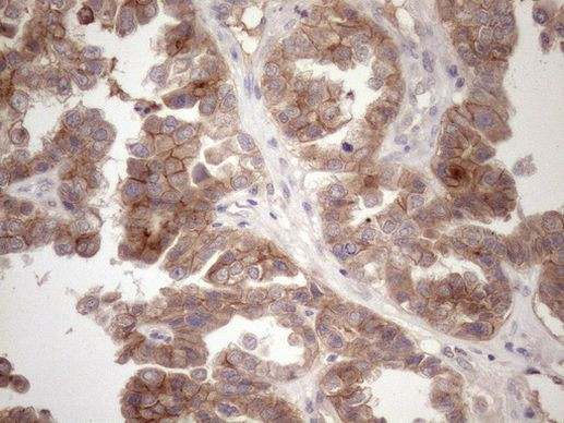 MET Antibody in Immunohistochemistry (Paraffin) (IHC (P))